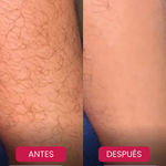 ByeByeVello™ ✨ DEPILACIÓN IPL SIN DOLOR ✨ 💎 Piel Suave y sin Heridas por Más Tiempo 💎