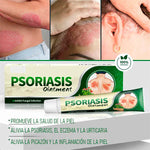 🍃CREMA PSORIASIS  Psoriasis Rápido y Recupera tu Piel Sana+ L799.99- envio gratis