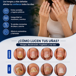 LumiNail Pro™ Tecnología de Fototerapia Láser para el Cuidado de las Uñas