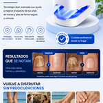 LumiNail Pro™ Tecnología de Fototerapia Láser para el Cuidado de las Uñas