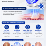 LumiNail Pro™ Tecnología de Fototerapia Láser para el Cuidado de las Uñas
