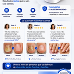 LumiNail Pro™ Tecnología de Fototerapia Láser para el Cuidado de las Uñas