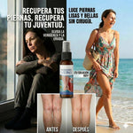✨ SPRAY VenoFresh® Alivio y Cuidado para las Várices 🦵🛡️