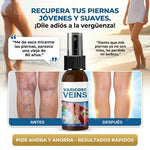 ✨ SPRAY VenoFresh® Alivio y Cuidado para las Várices 🦵🛡️