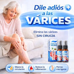 ✨ SPRAY VenoFresh® Alivio y Cuidado para las Várices 🦵🛡️